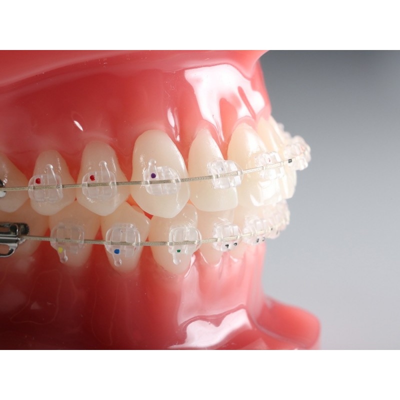 Kit de Brackets Cerámica VAPOR Roth-3