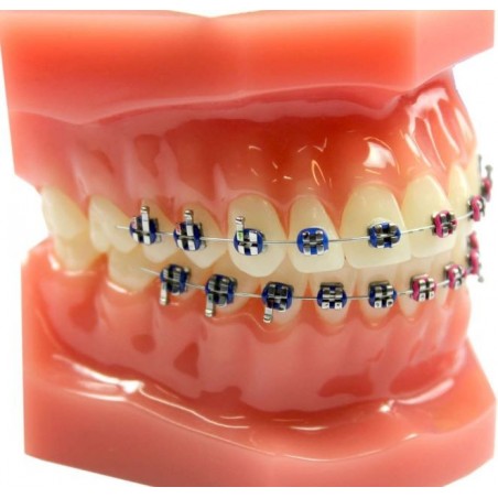 TIPODONTO MODELO DEMOSTRACIÓN CON BRACKETS CEMENTADOS