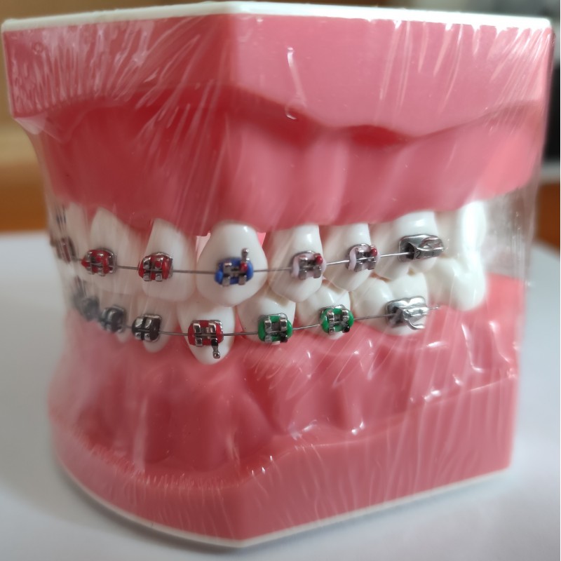 TIPODONTO MODELO DEMOSTRACIÓN CON BRACKETS CEMENTADOS-1