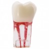 Molar con conductos radiculares-0