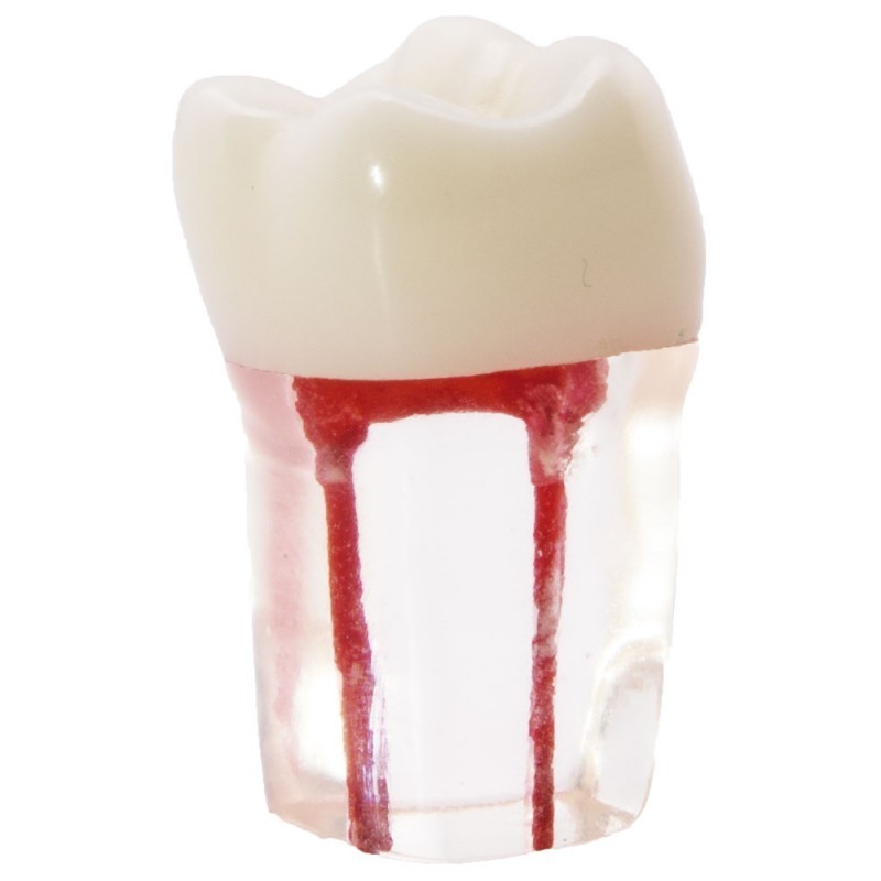 Molar con conductos radiculares-1