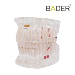 Modelo dental transparente con implante