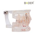 Modelo dental transparente con implante-2