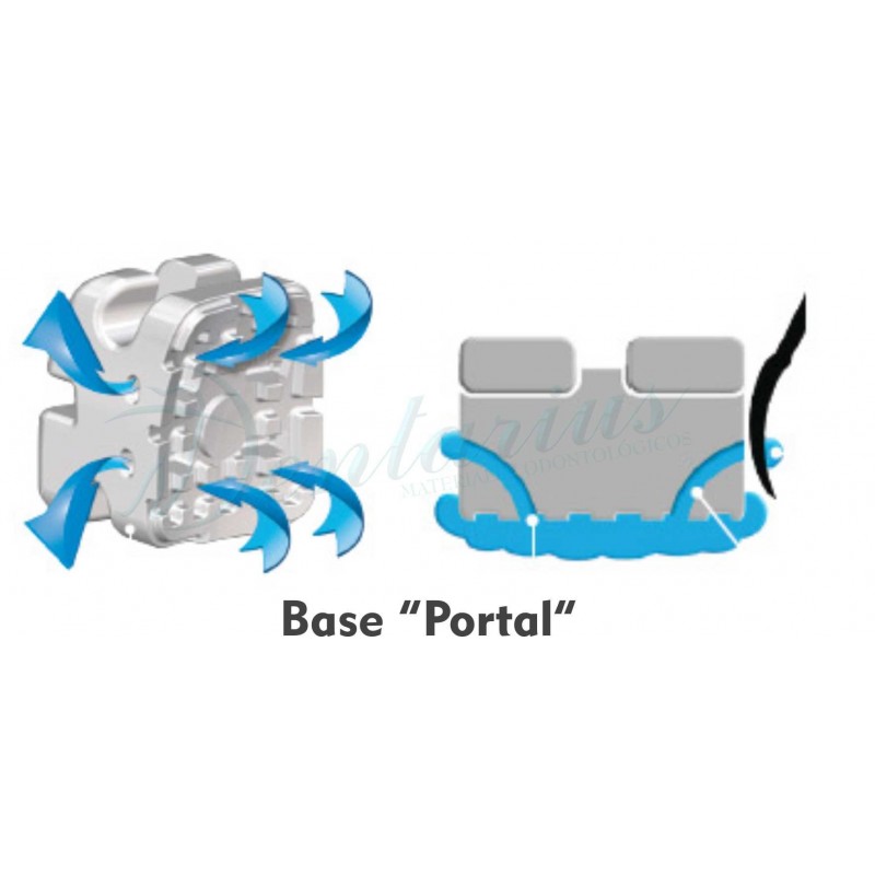 Reposición Brackets Cerámica VAPOR ROTH 018-1