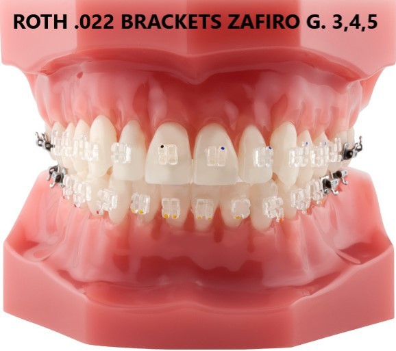 Contrangolo Dentista Soportes Autoligantes De Metal De Ortodoncia Dental Para Brace MBT/Roth 0.022" 3.4.5 Con Ganchos (ROTH 022 3 Dentifricio Colgate - Foto 2